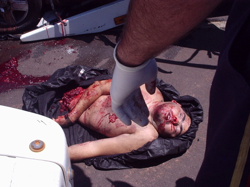  images below …you might view some of the most horrific accident photos!